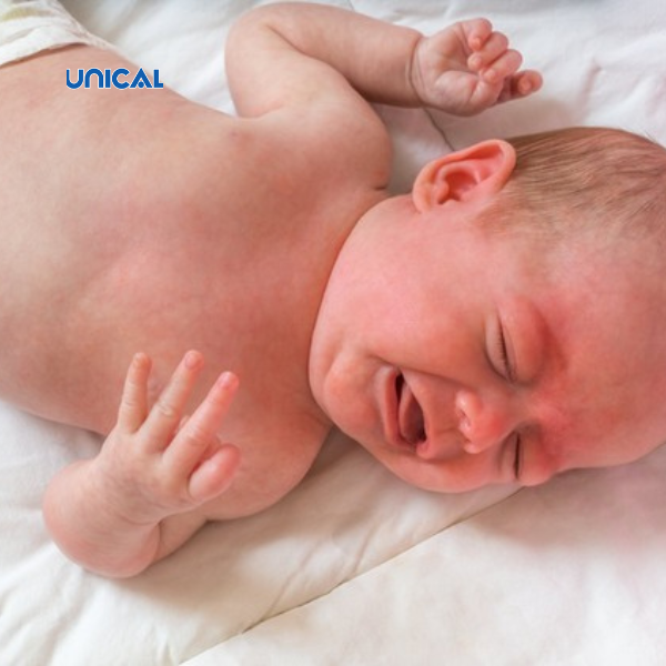 Hạ canxi máu có thể làm trẻ sơ sinh bị co giật