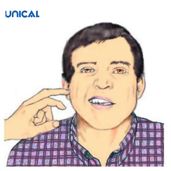 Dấu Chovostek là một dấu hiệu điển hình của hạ canxi