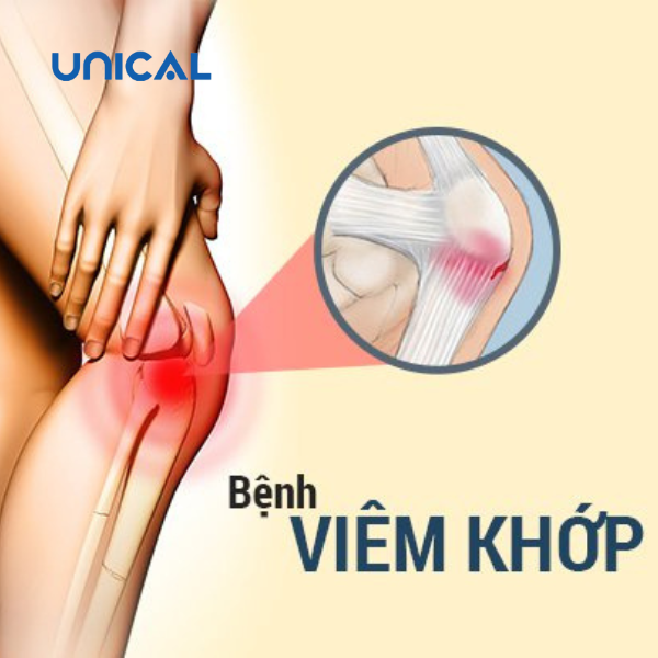 Thiếu canxi ở người lớn gây ra bệnh về xương khớp